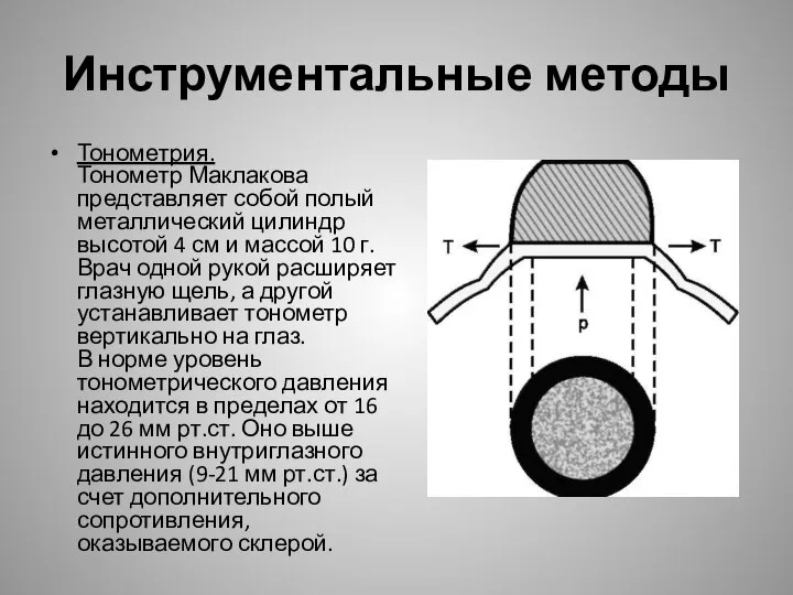 Инструментальные методы Тонометрия. Тонометр Маклакова представляет собой полый металлический цилиндр высотой