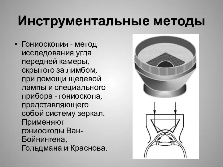 Гониоскопия - метод исследования угла передней камеры, скрытого за лимбом, при