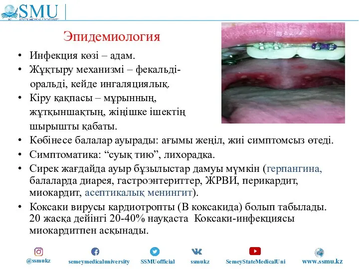 Эпидемиология Инфекция көзі – адам. Жұқтыру механизмі – фекальді- оральді, кейде