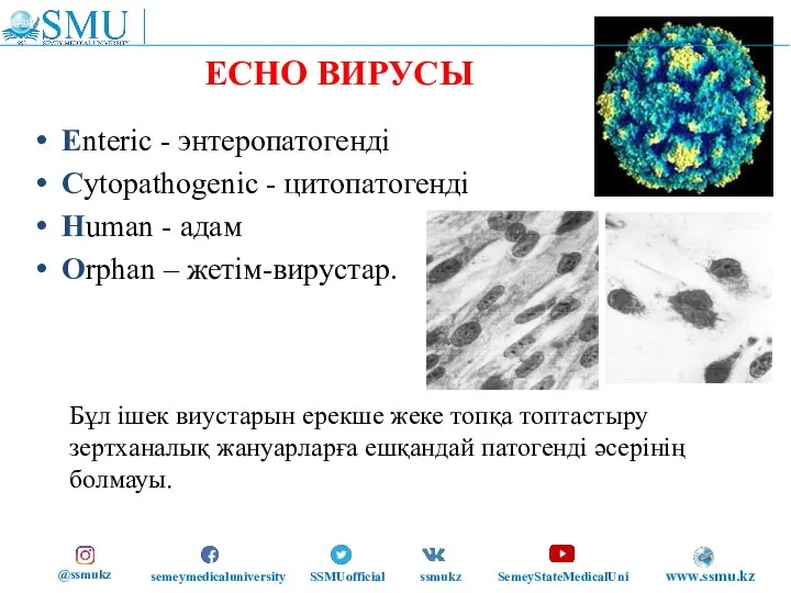 ЕСНО ВИРУСЫ Enteric - энтеропатогенді Cytopathogenic - цитопатогенді Human - адам