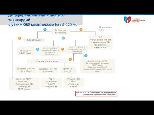 Дифференциальный диагноз тахикардий с узким QRS-комплексом (qrs ≤ 120 мс) Регулярная