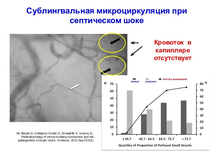 Сублингвальная микроциркуляция при септическом шоке Кровоток в капилляре отсутствует De Backer