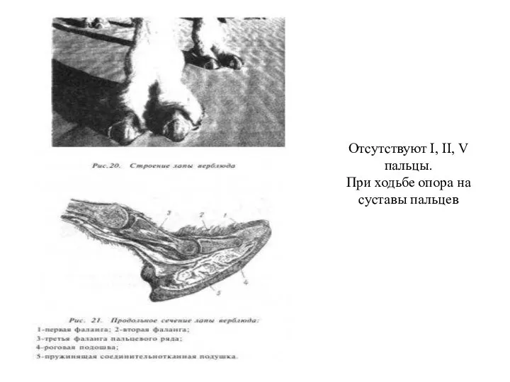 Отсутствуют I, II, V пальцы. При ходьбе опора на суставы пальцев