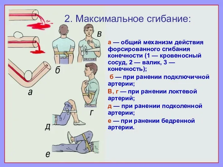 а — общий механизм действия форсированного сгибания конечности (1 — кровеносный