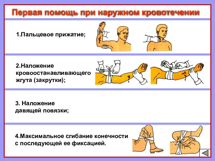 Первая помощь при наружном кровотечении 1.Пальцевое прижатие; 2.Наложение кровоостанавливающего жгута (закрутки);