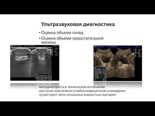 Ультразвуковая диагностика Оценка объема гонад Оценка объема предстательной железы -методика проста