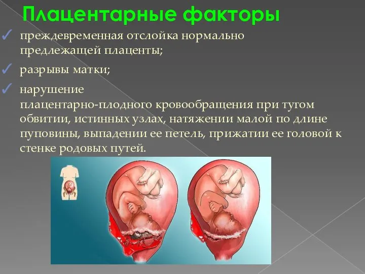 Плацентарные факторы преждевременная отслойка нормально предлежащей плаценты; разрывы матки; нарушение плацентарно-плодного