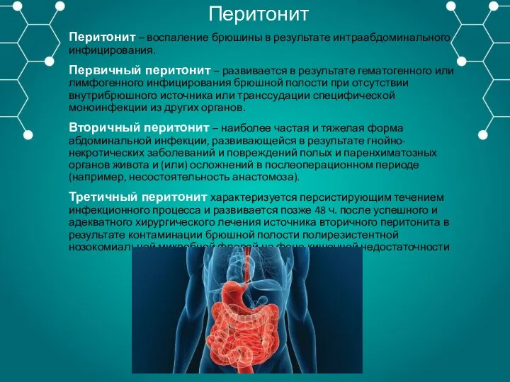 Перитонит Перитонит – воспаление брюшины в результате интраабдоминального инфицирования. Первичный перитонит