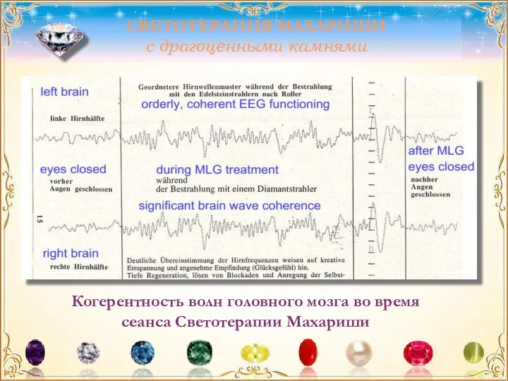Когерентность волн головного мозга во время сеанса Светотерапии Махариши СВЕТОТЕРАПИЯ МАХАРИШИ с драгоценными камнями