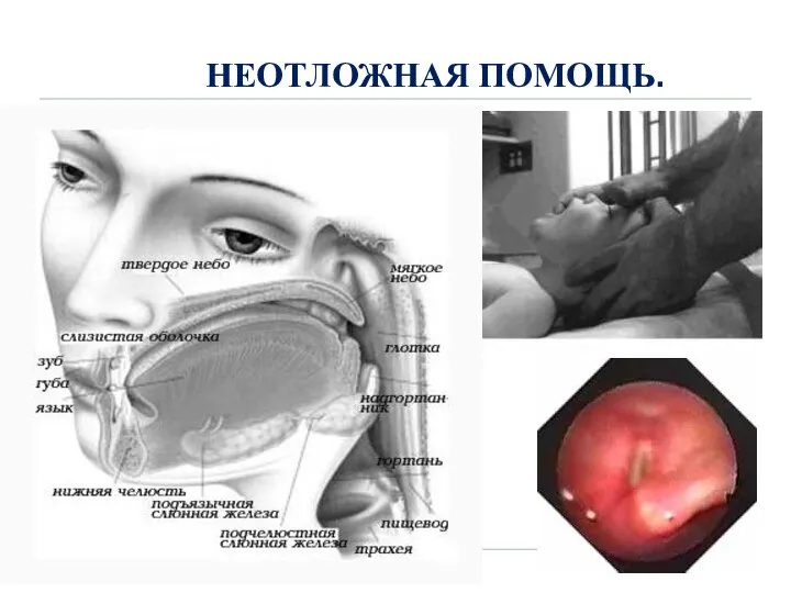 НЕОТЛОЖНАЯ ПОМОЩЬ.