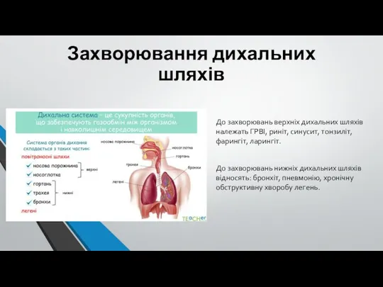 Захворювання дихальних шляхів До захворювань верхніх дихальних шляхів належать ГРВІ, риніт,