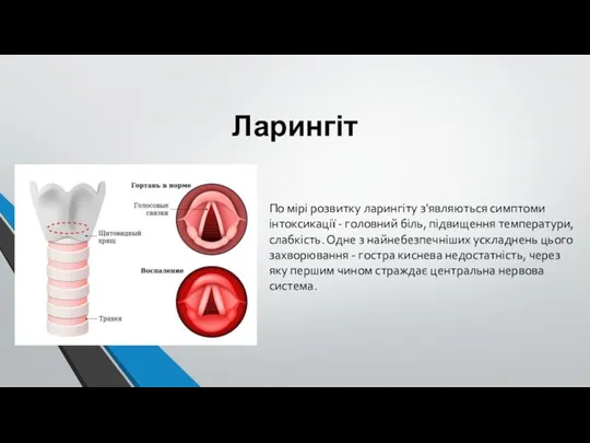 Ларингіт По мірі розвитку ларингіту з'являються симптоми інтоксикації - головний біль,