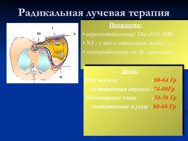 Радикальная лучевая терапия Показания: • нерезектабельные T4а-dN0-3M0 . • N3 -