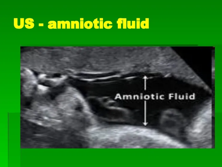 US - amniotic fluid