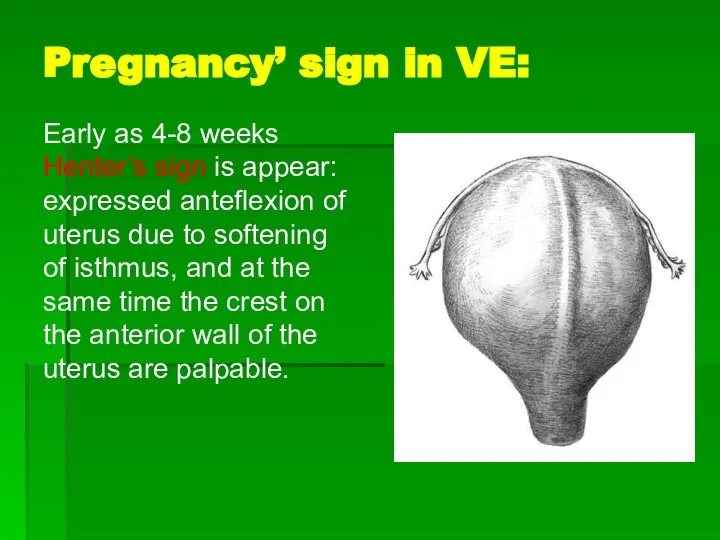 Pregnancy’ sign in VE: Early as 4-8 weeks Henter’s sign is