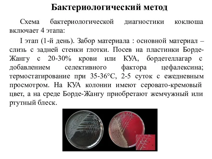 Бактериологический метод Схема бактериологической диагностики коклюша включает 4 этапа: I этап