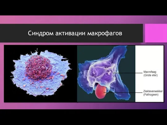 Синдром активации макрофагов