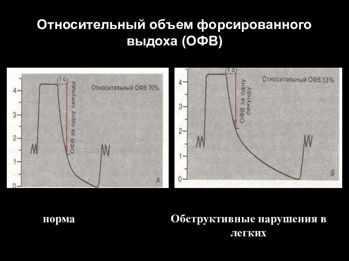 Относительный объем форсированного выдоха (ОФВ) норма Обструктивные нарушения в легких