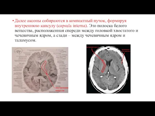 Далее аксоны собираются в компактный пучок, формируя внутреннюю капсулу (capsula interna).