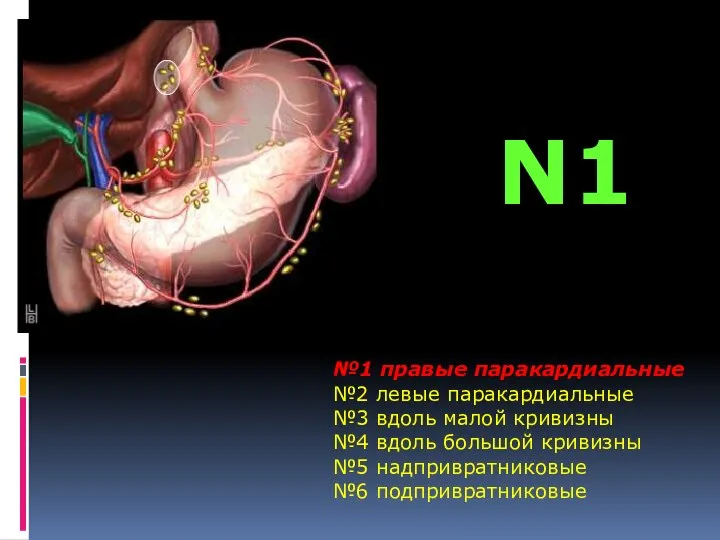 №1 правые паракардиальные №2 левые паракардиальные №3 вдоль малой кривизны №4