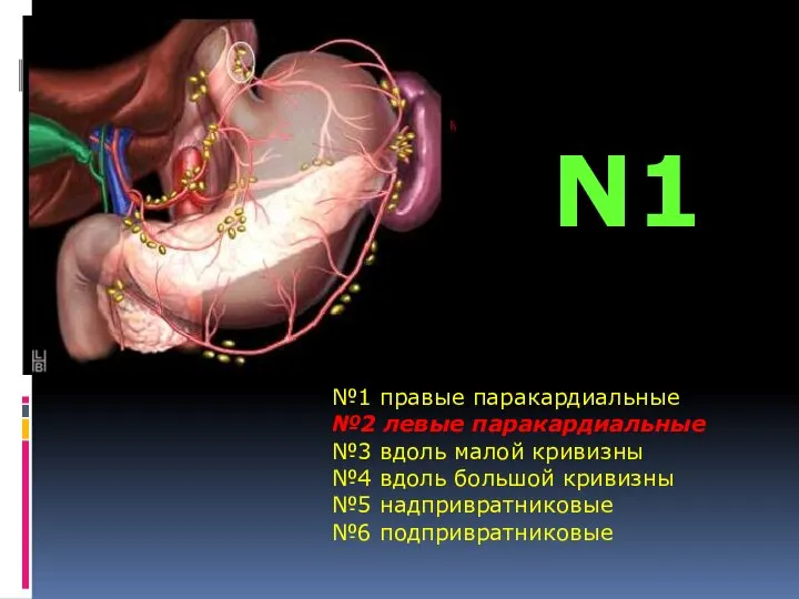 №1 правые паракардиальные №2 левые паракардиальные №3 вдоль малой кривизны №4