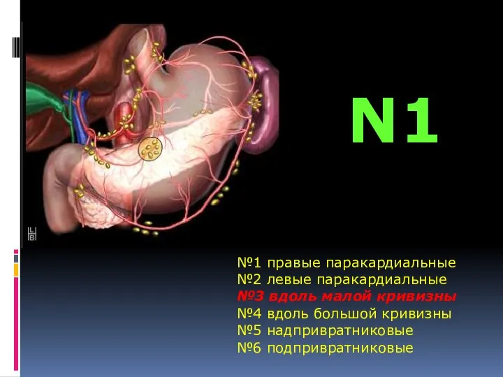 №1 правые паракардиальные №2 левые паракардиальные №3 вдоль малой кривизны №4