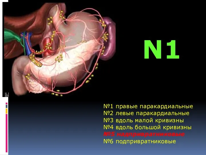 №1 правые паракардиальные №2 левые паракардиальные №3 вдоль малой кривизны №4