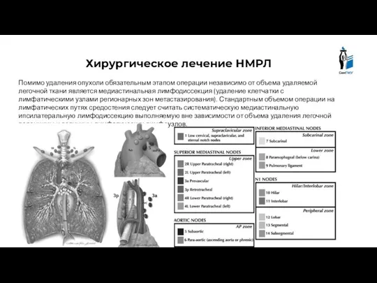 Хирургическое лечение НМРЛ Помимо удаления опухоли обязательным этапом операции независимо от