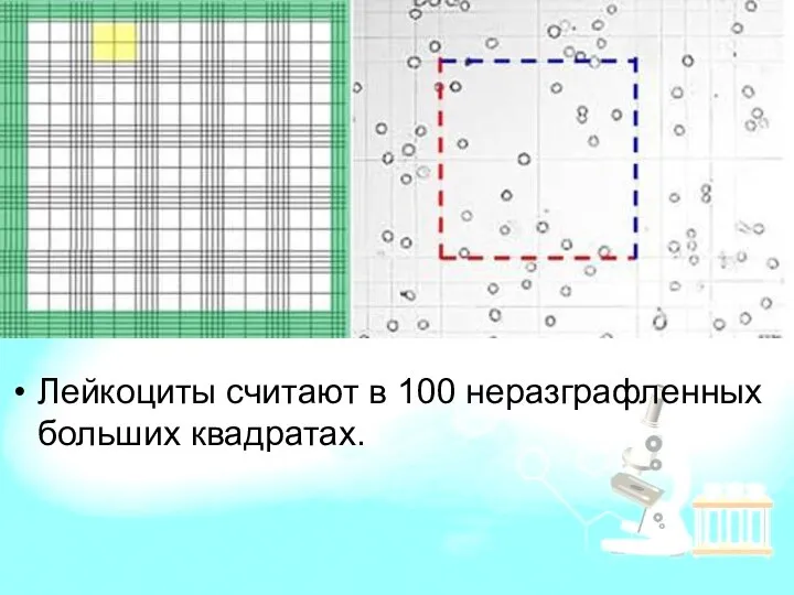 Лейкоциты считают в 100 неразграфленных больших квадратах.