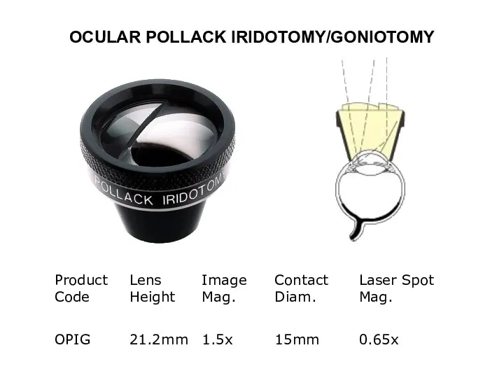 OCULAR POLLACK IRIDOTOMY/GONIOTOMY