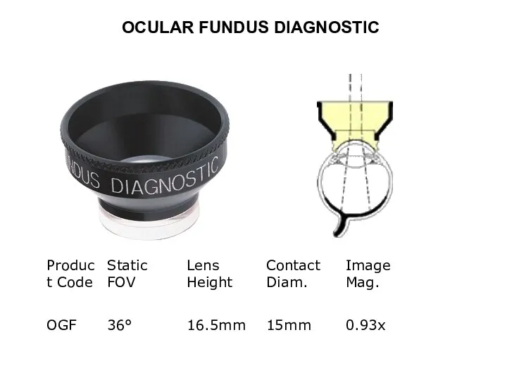 OCULAR FUNDUS DIAGNOSTIC