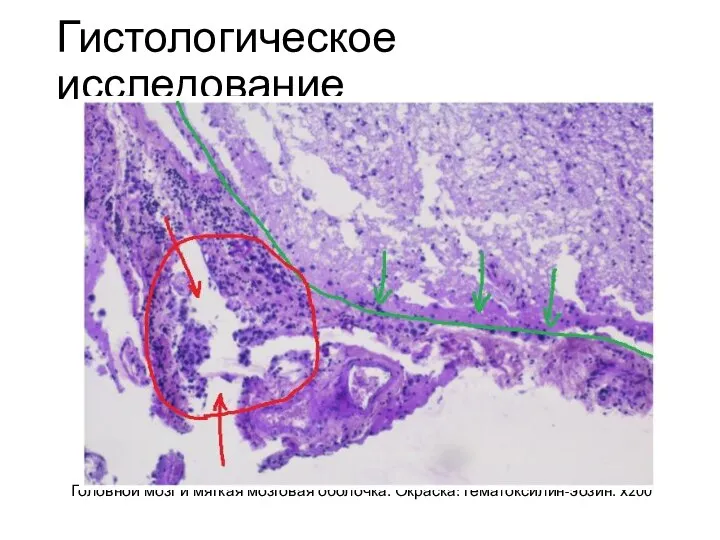 Гистологическое исследование Головной мозг и мягкая мозговая оболочка. Окраска: гематоксилин-эозин. х200