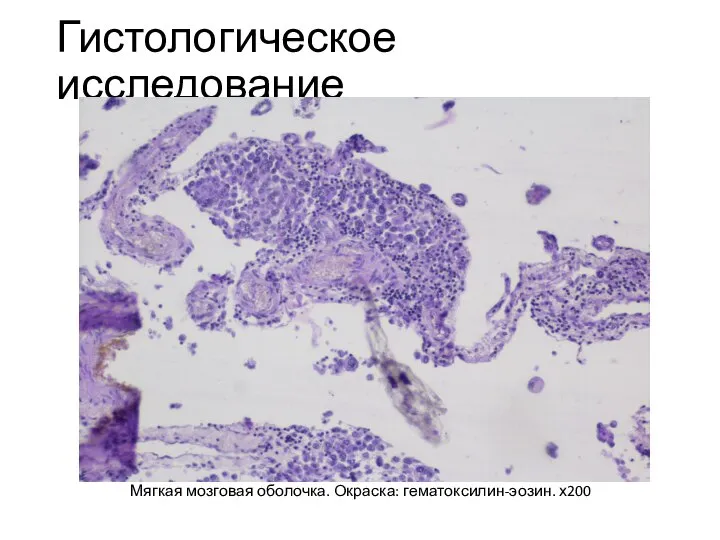 Гистологическое исследование Мягкая мозговая оболочка. Окраска: гематоксилин-эозин. х200