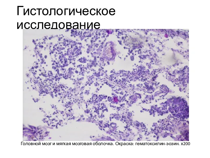 Гистологическое исследование Головной мозг и мягкая мозговая оболочка. Окраска: гематоксилин-эозин. х200