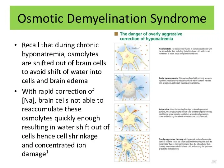 Osmotic Demyelination Syndrome Recall that during chronic hyponatremia, osmolytes are shifted
