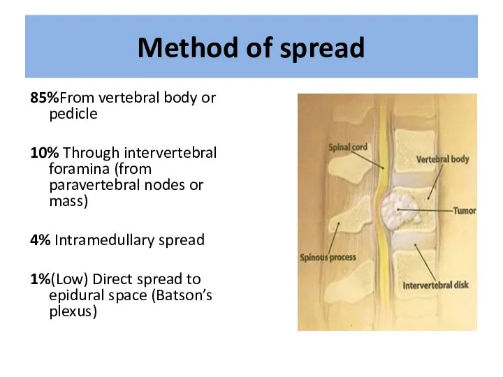 Method of spread 85%From vertebral body or pedicle 10% Through intervertebral