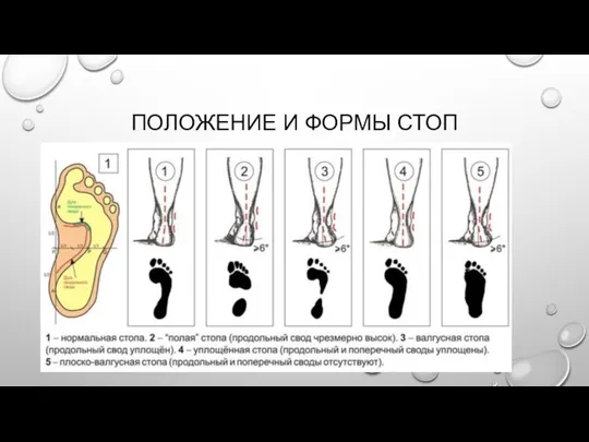 ПОЛОЖЕНИЕ И ФОРМЫ СТОП