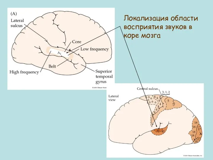 Локализация области восприятия звуков в коре мозга