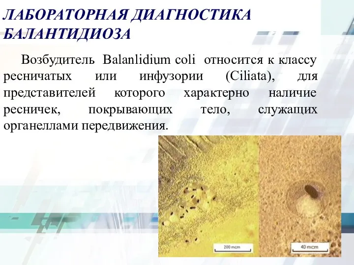 ЛАБОРАТОРНАЯ ДИАГНОСТИКА БАЛАНТИДИОЗА Возбудитель Balanlidium coli относится к классу ресничатых или