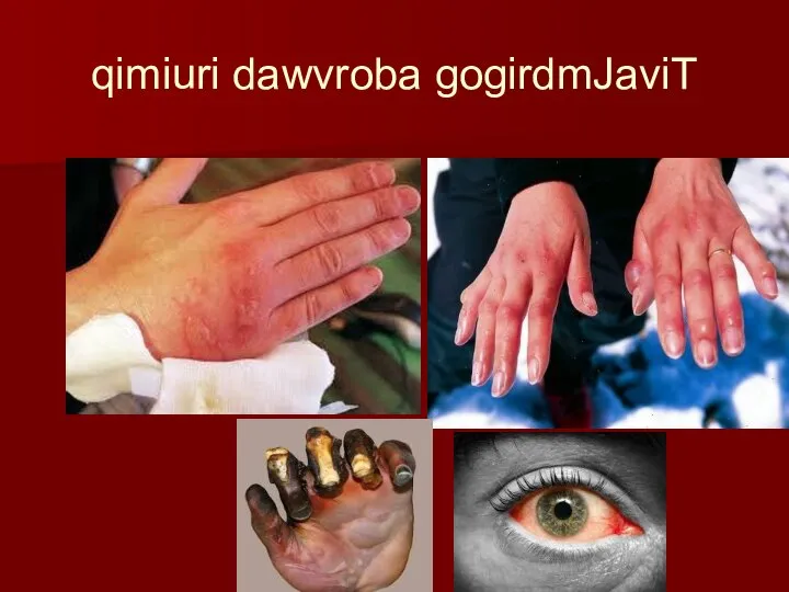 qimiuri dawvroba gogirdmJaviT