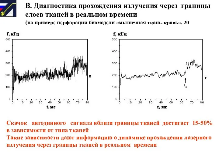 В. Диагностика прохождения излучения через границы слоев тканей в реальном времени