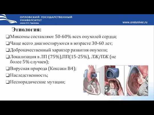 Этиология: Миксомы составляют 50-60% всех опухолей сердца; Чаще всего диагностируются в