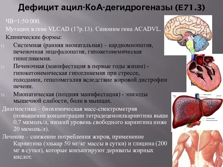 Дефицит ацил-КоА-дегидрогеназы (Е71.3) ЧВ=1:50 000. Мутации в гене VLCAD (17p.13). Синоним