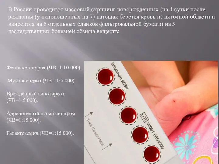 В России проводится массовый скрининг новорожденных (на 4 сутки после рождения