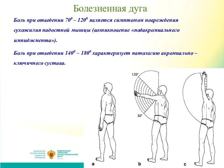 Болезненная дуга Боль при отведении 700 – 1200 является симптомом повреждения