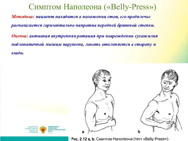 Симптом Наполеона («Belly-Press») Методика: пациент находится в положении стоя, его предплечье