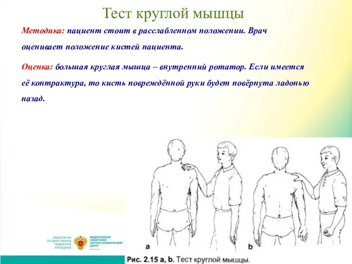 Тест круглой мышцы Методика: пациент стоит в расслабленном положении. Врач оценивает