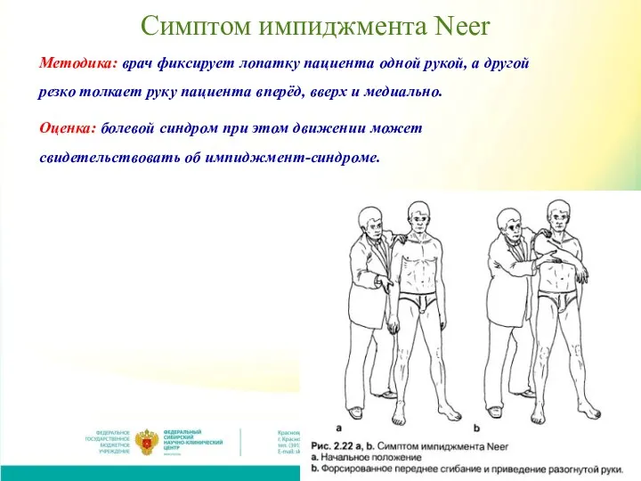 Симптом импиджмента Neer Методика: врач фиксирует лопатку пациента одной рукой, а