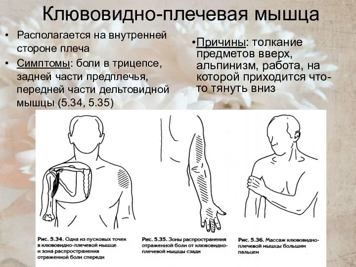 Клювовидно-плечевая мышца Располагается на внутренней стороне плеча Симптомы: боли в трицепсе,