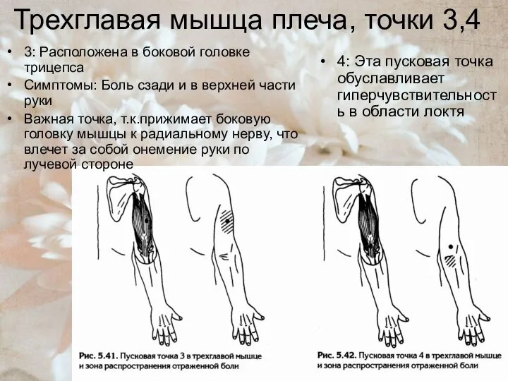 Трехглавая мышца плеча, точки 3,4 3: Расположена в боковой головке трицепса